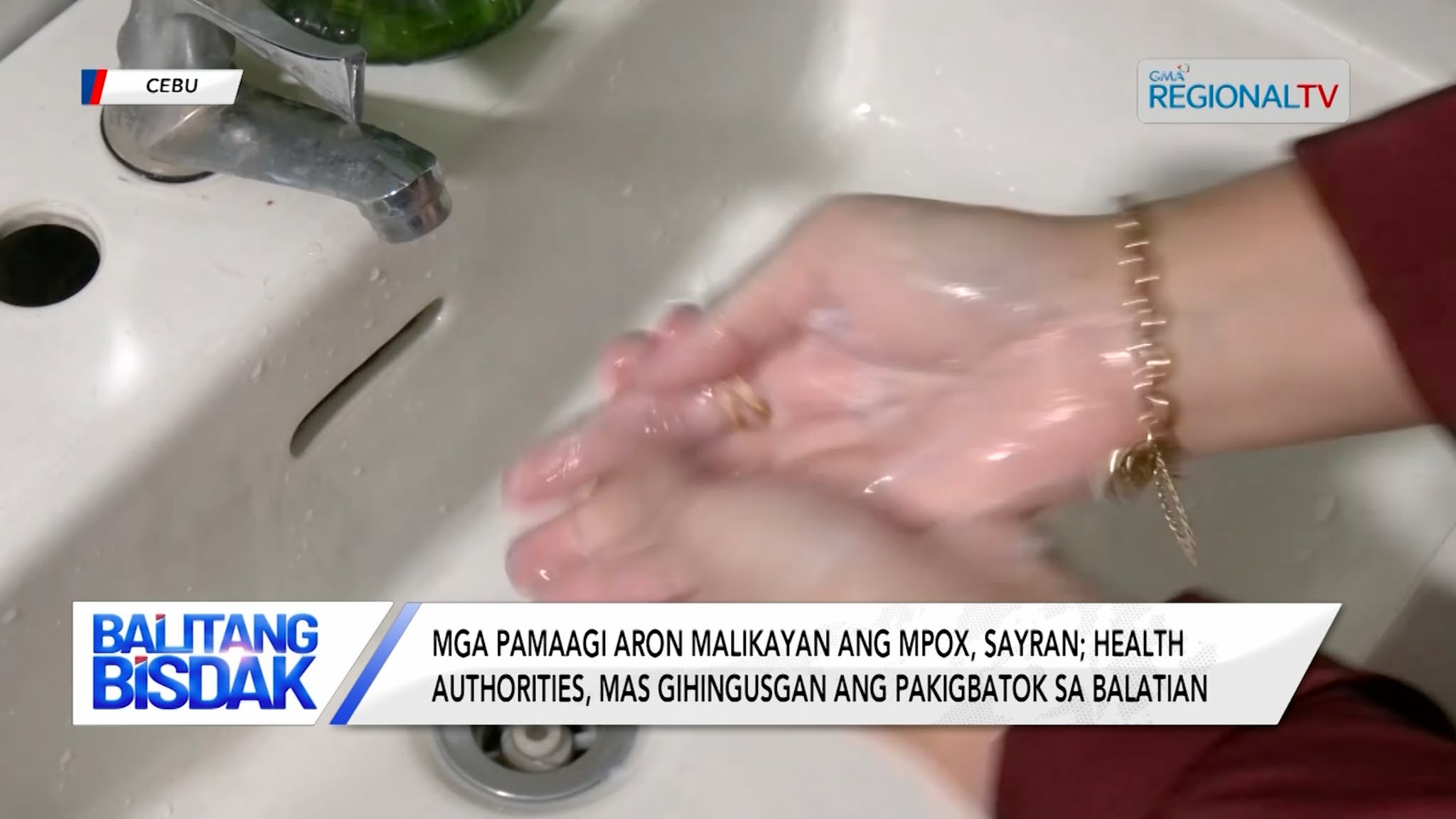 Mga pamaagi aron malikayan ang Mpox, sayran