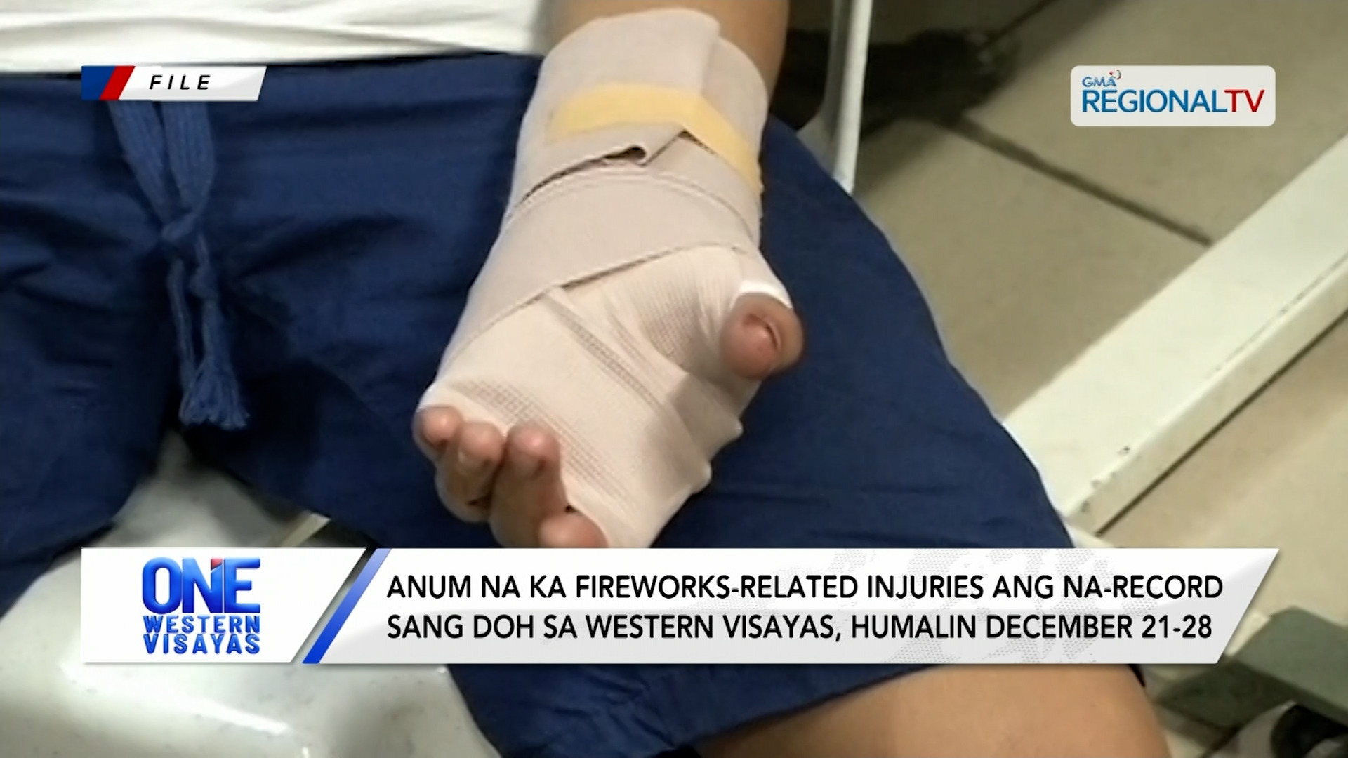 Anum na ka fireworks-related injuries ang na-record sang DOH sa Western Visayas| One Western Visayas