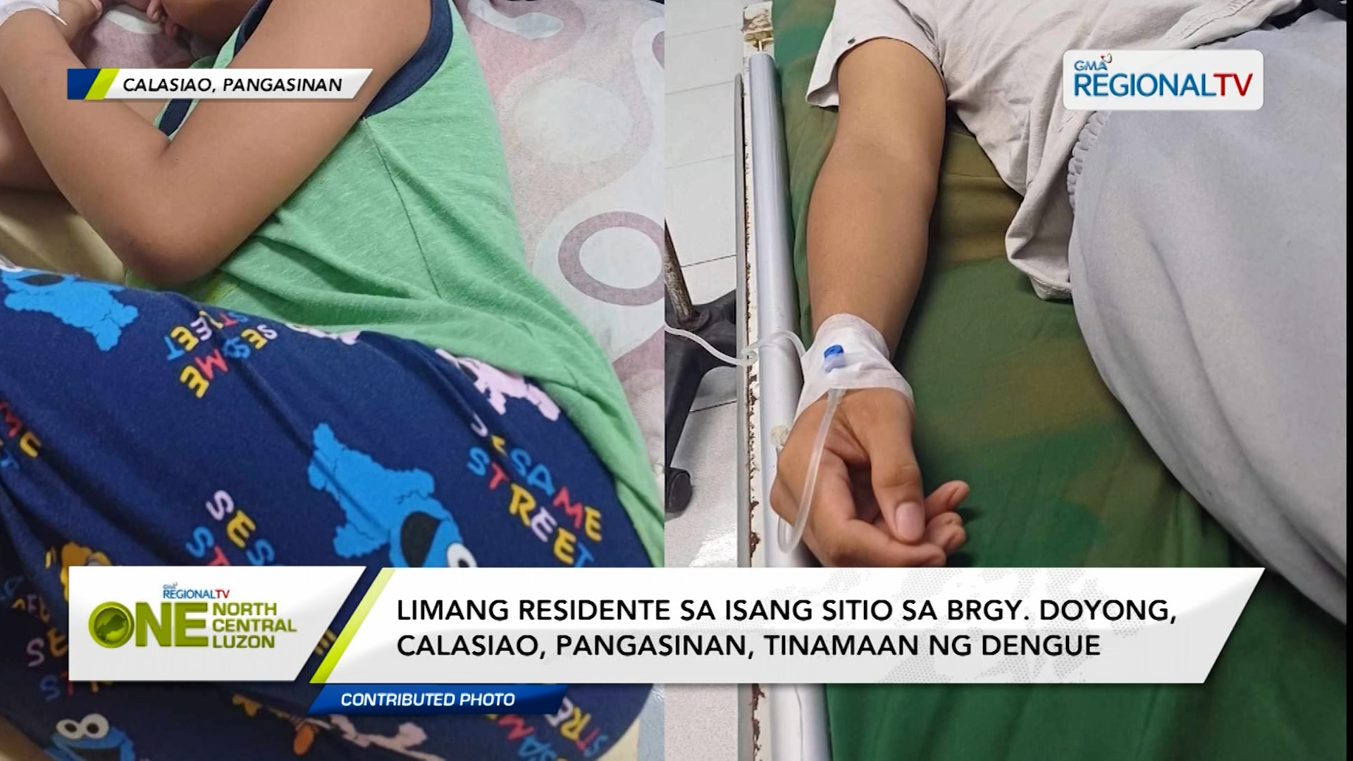 5 residente sa Brgy. Doyong, Calasiao, Pangasinan, tinamaan ng dengue