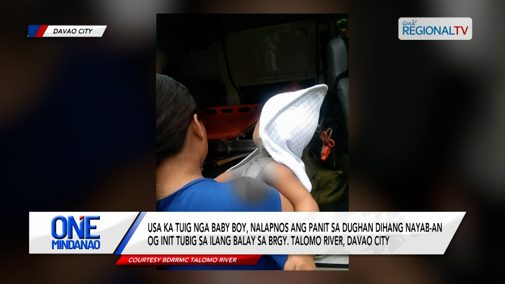 Usa ka tuig nga baby boy, nalapnos ang dughan dihang nayab-an og init tubig