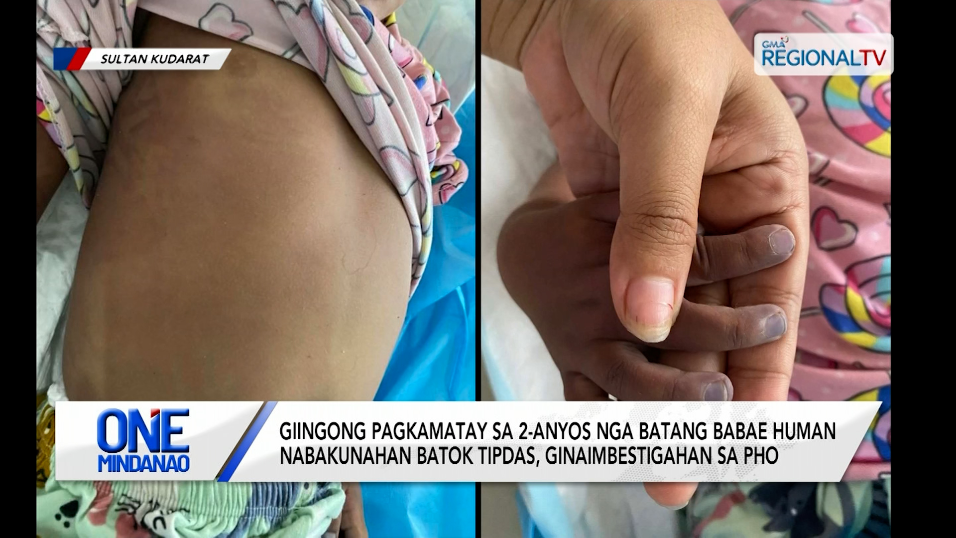 Pagkamatay sa 2-anyos nga babae human nabakunahan batok tipdas, ginaimbestigahan | One Mindanao