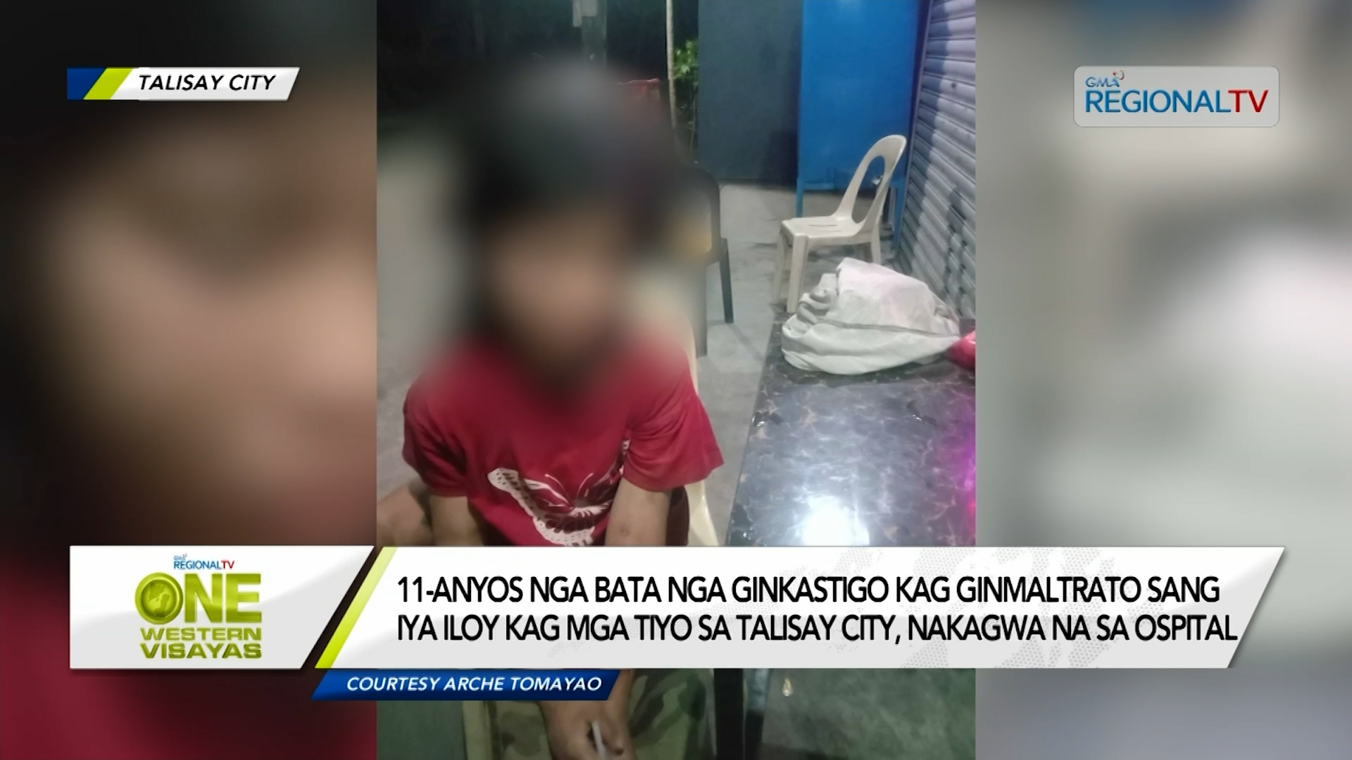 Bata nga ginmaltrato sang iya iloy kag mga tiyo, nakagwa na sa ospital