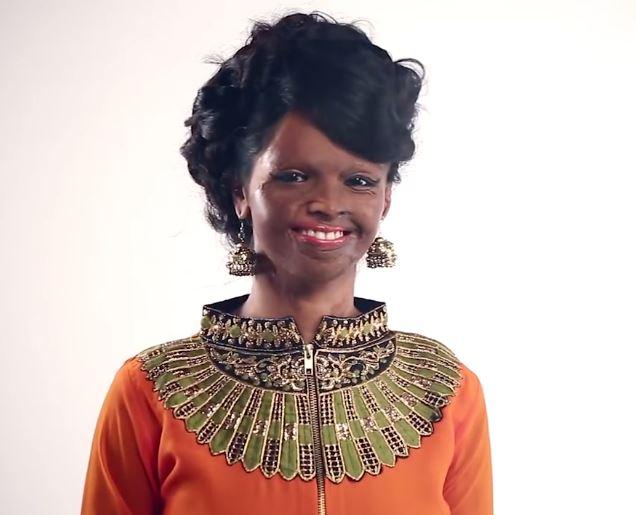 Indian acid-attack survivor becomes face of fashion brand | GMA News Online