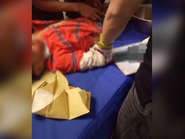 DOH to shoulder treatment of firecracker victims | GMA News Online