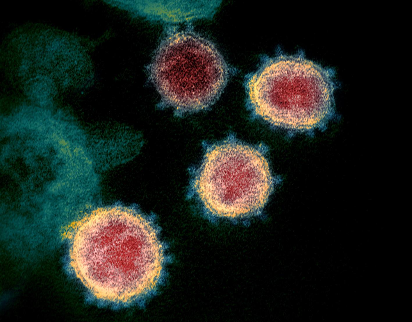 Coronavirus variant first discovered in Philippines investigated in England