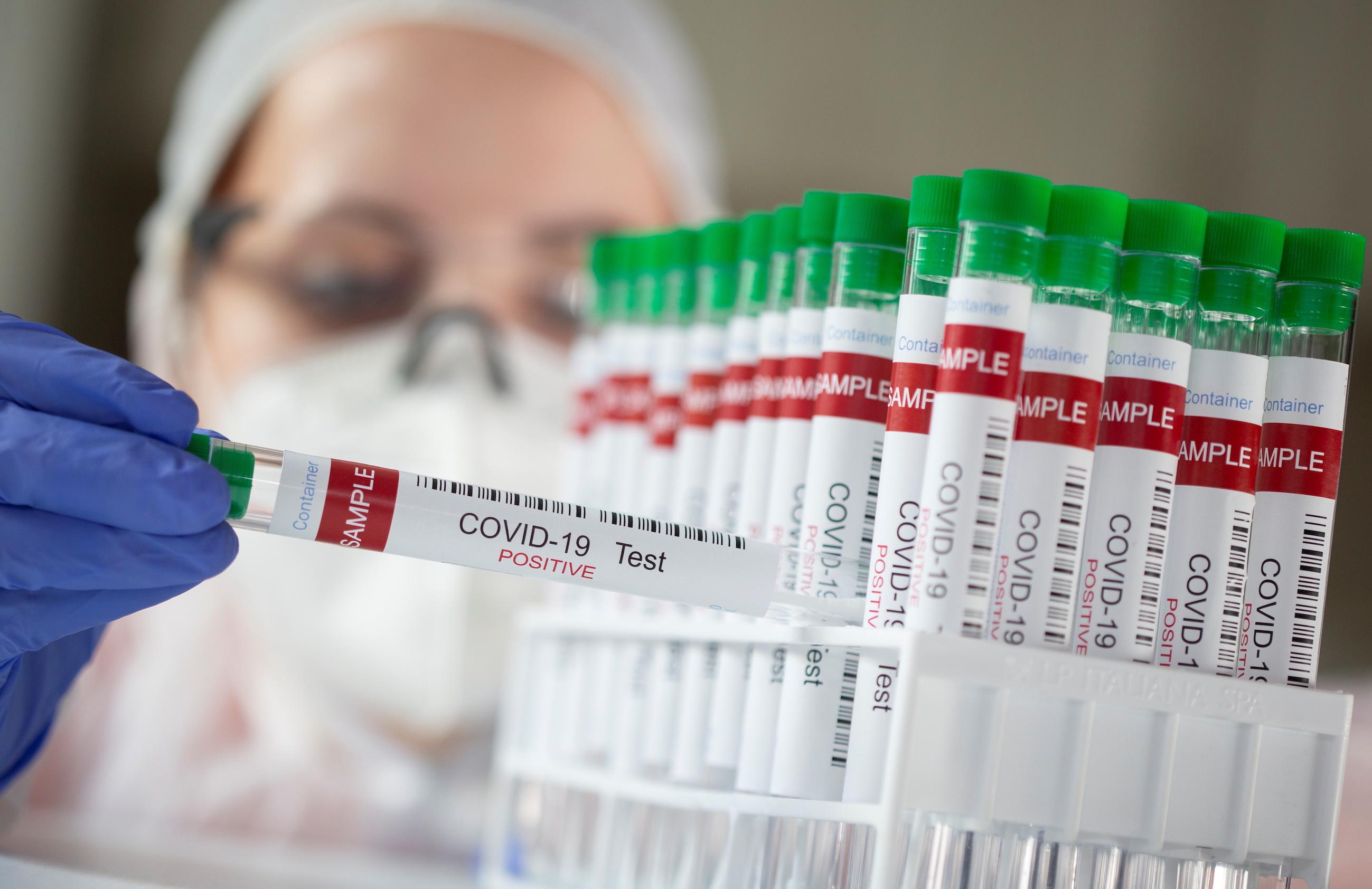 Worldwide coronavirus cases cross 118.82 million, death toll at 2,760,596 —Reuters tally