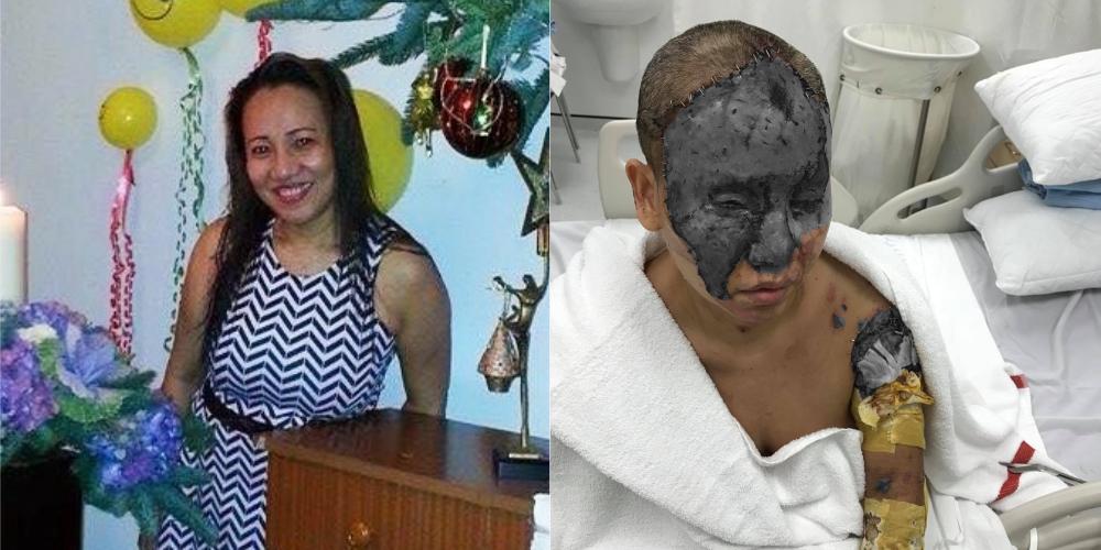 Former OFW in Dubai goes blind after Kenyan woman throws acid in her