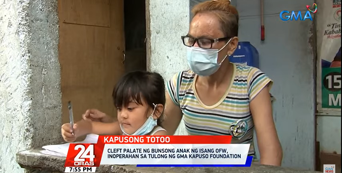 Daughter of OFW gets cleft palate surgery thanks to Kapuso Foundation ...