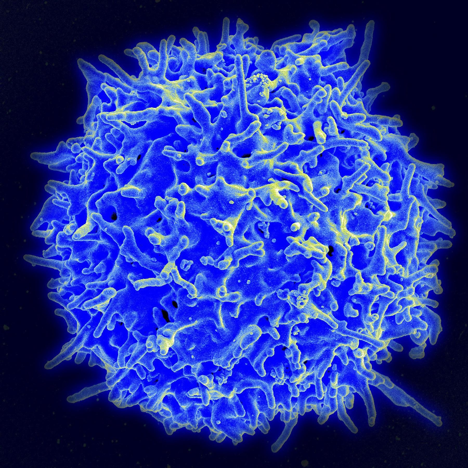 Sel-T dari flu biasa dapat memberikan perlindungan vs. COVID-19 —penelitian di Inggris GMA News Online