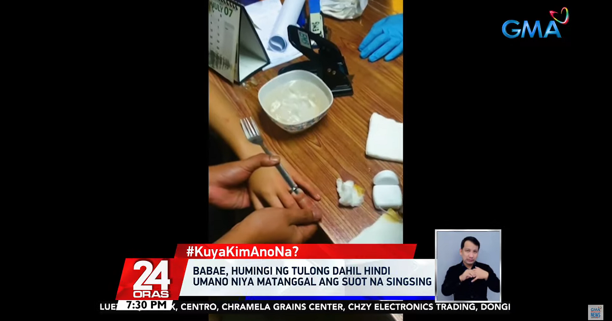 Gadis 14 tahun di Cebu meminta bantuan setelah cincin tersangkut di jarinya