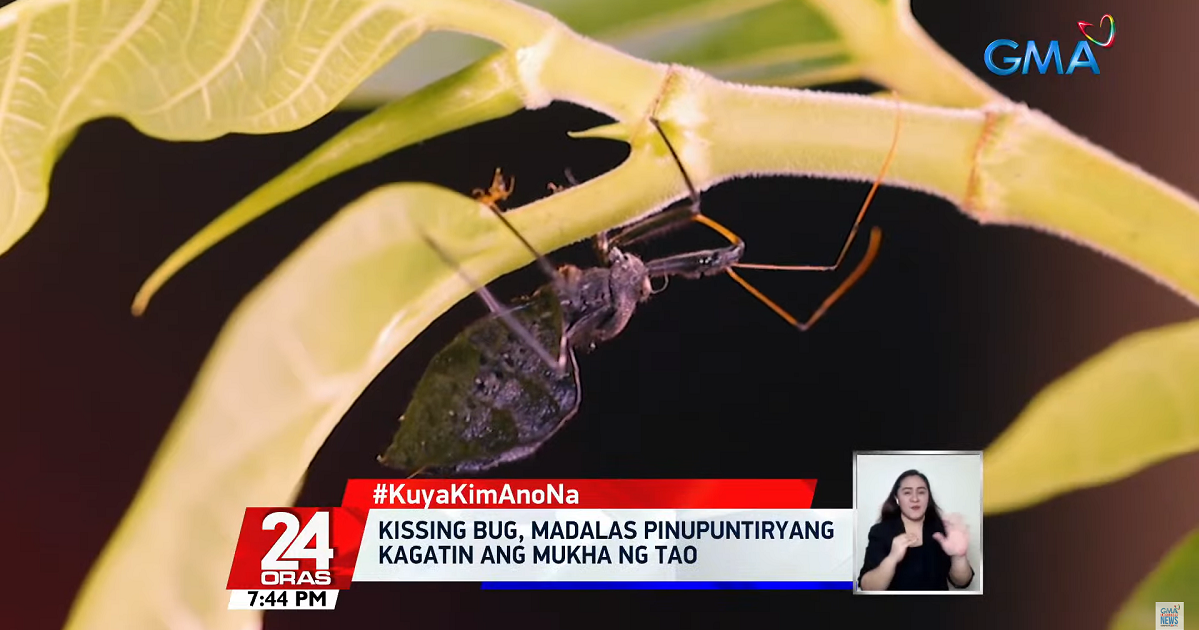 Student from Davao De Oro gets hospitalized after getting bitten by ‘kissing bug’