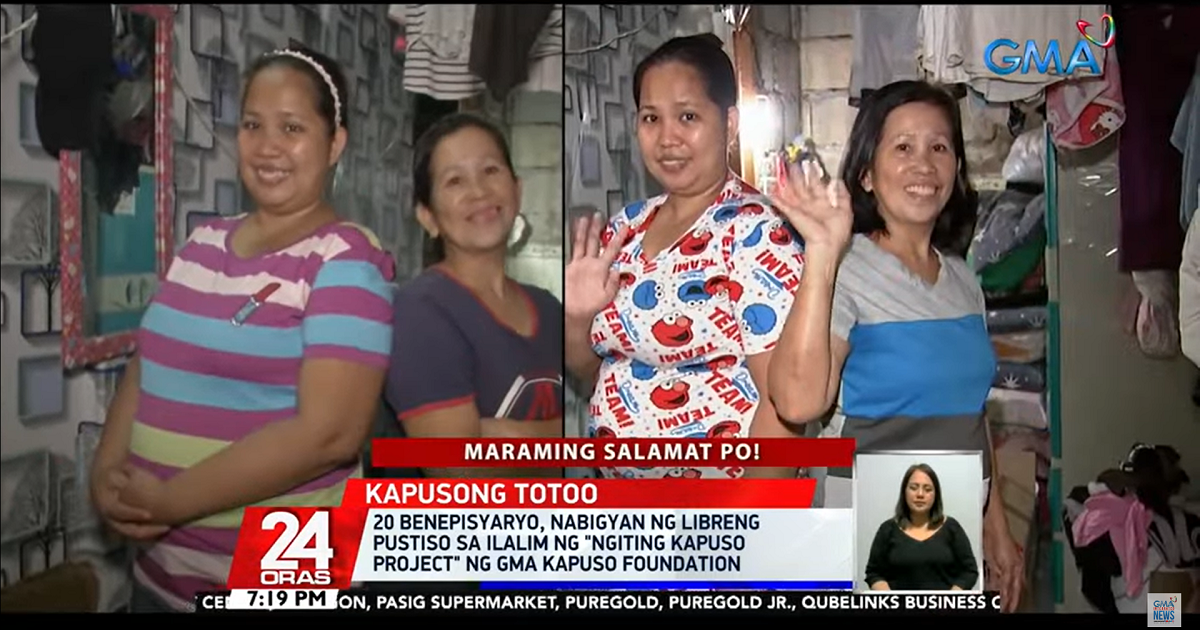 20 beneficiaries get new dentures from GMA Kapuso Foundation