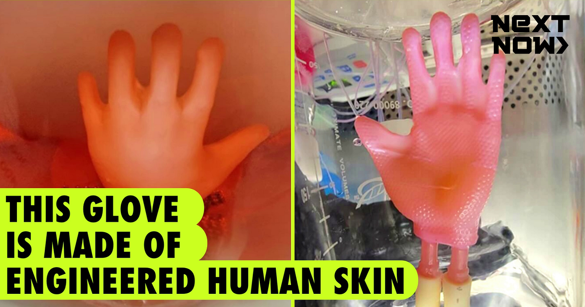 Artificial human skin used to make gloves for patients with burns on