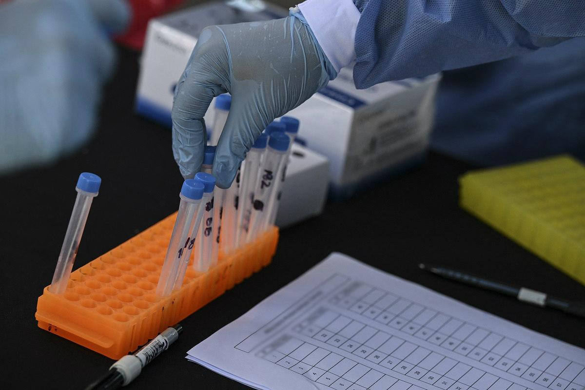 Philippines logs 521 new COVID-19 cases, active tally at 53-day low