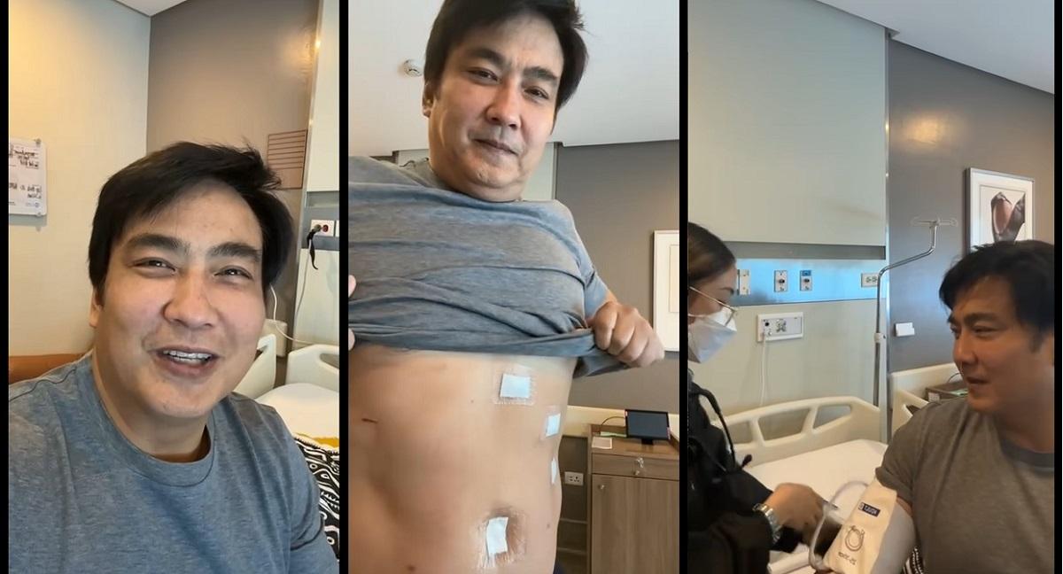 ‘May agimat pa rin’: Bong Revilla recovers from gallbladder surgery