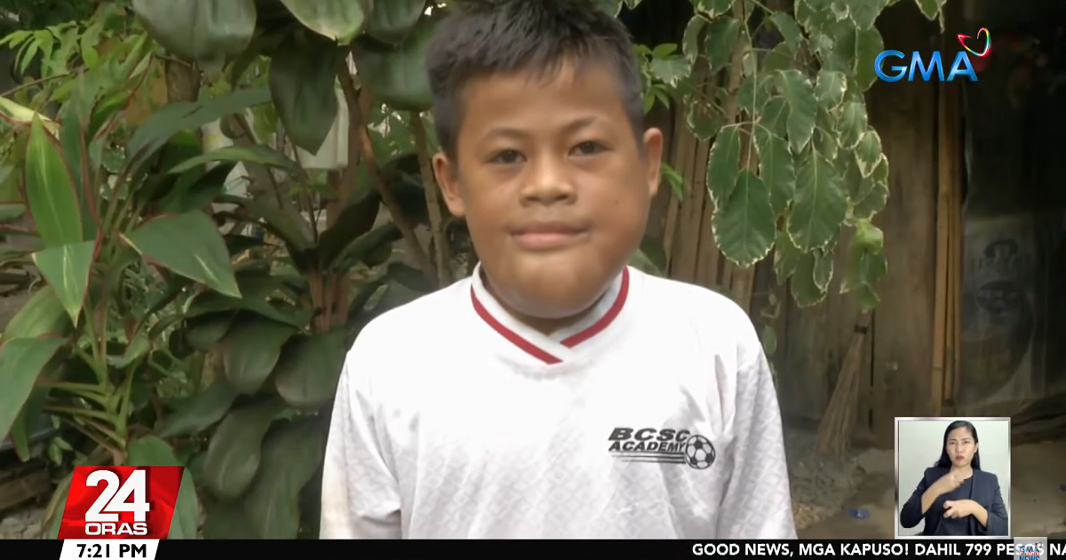 12-year-old boy from Isabela seeks medical help for lump on his face