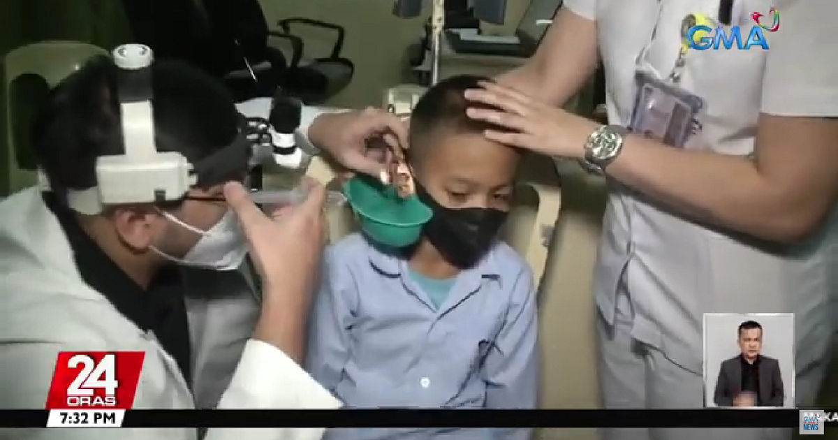 8-year-old boy from Pangasinan suffers from fever for over a month after stone gets into his ear