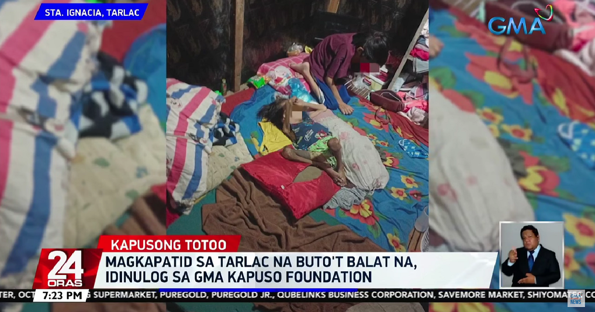 2 brothers suffering from chronic malnutrition receive help from GMA Kapuso Foundation