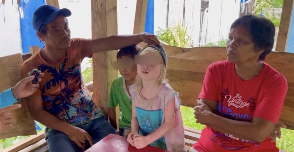 Man pretending to be charity vlogger’s staff kidnaps child with albinism from Camarines Sur