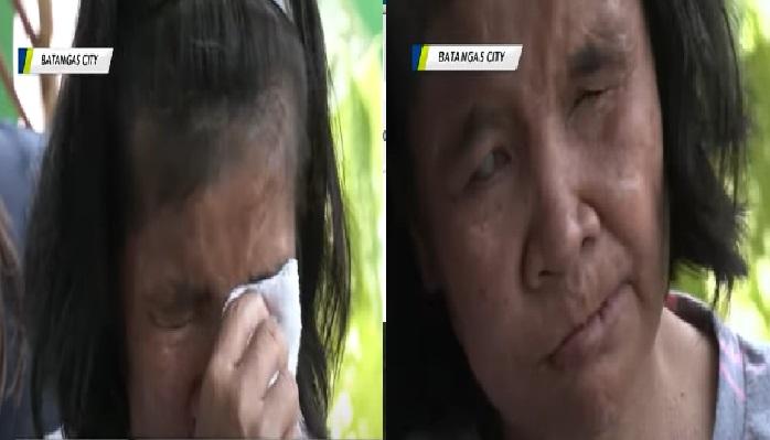 Helper in Mindoro who went partially blind after employer’s abuse unlikely to recover vision, says doctor