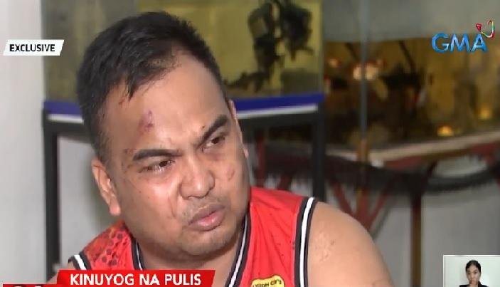 Nakasibilyang pulis, sugatan matapos kuyugin ng ilang lalaki; biktima ...