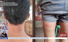 19 anyos binugbog ng pulis
