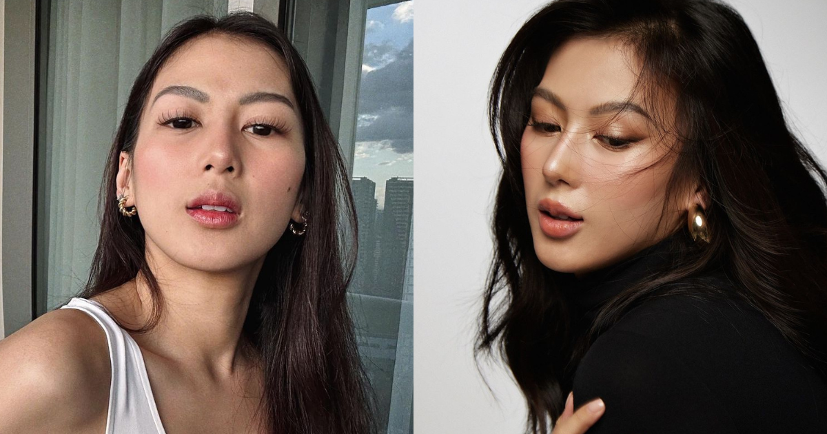 Alex Gonzaga on getting her nose done: 'Do what makes you happy'