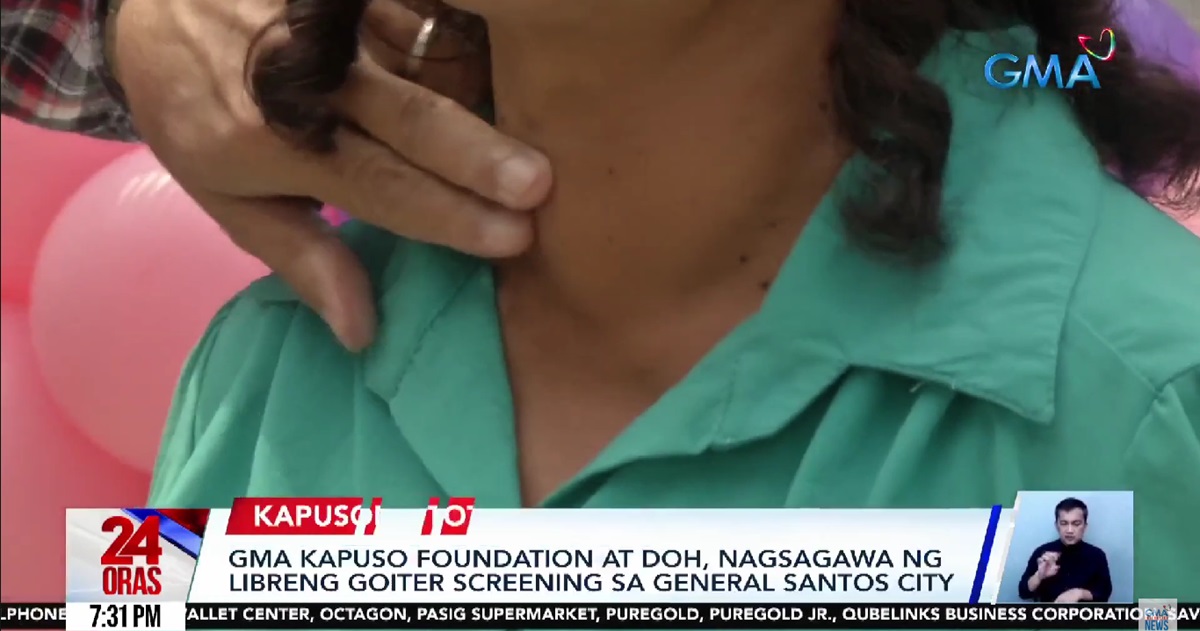 GenSan residents receive free goiter screening from DOH, GMA Kapuso Foundation