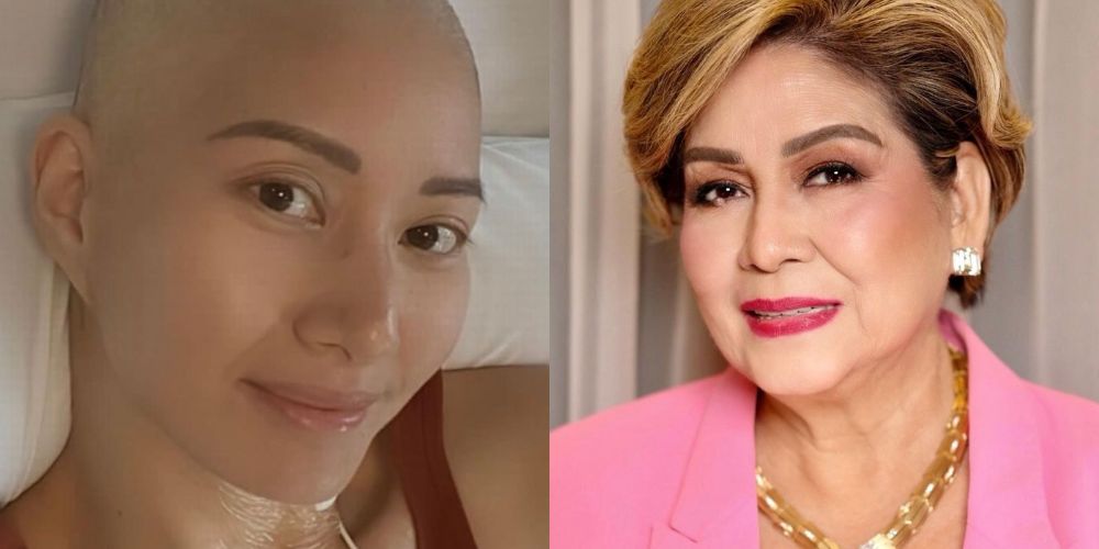 Annabelle Rama to daughter-in-law Alexa who has leukemia: 'Ikaw ang pinaka magandang kalbo'