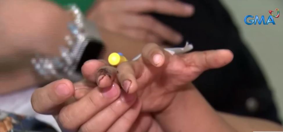 4 more hit by stray bullets during New Year revelry | GMA News Online