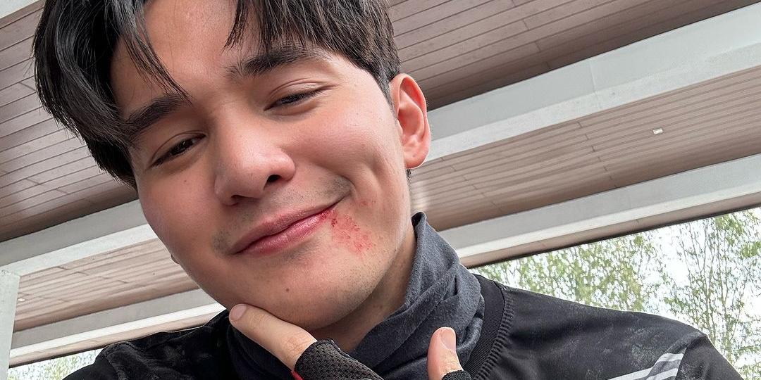 Ruru Madrid back to taping 'Black Rider’ after ER incident'