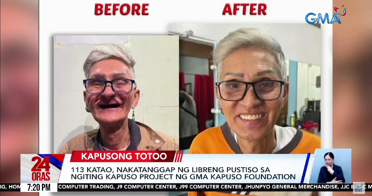 113 individuals receive free dentures from GMA Kapuso Foundation