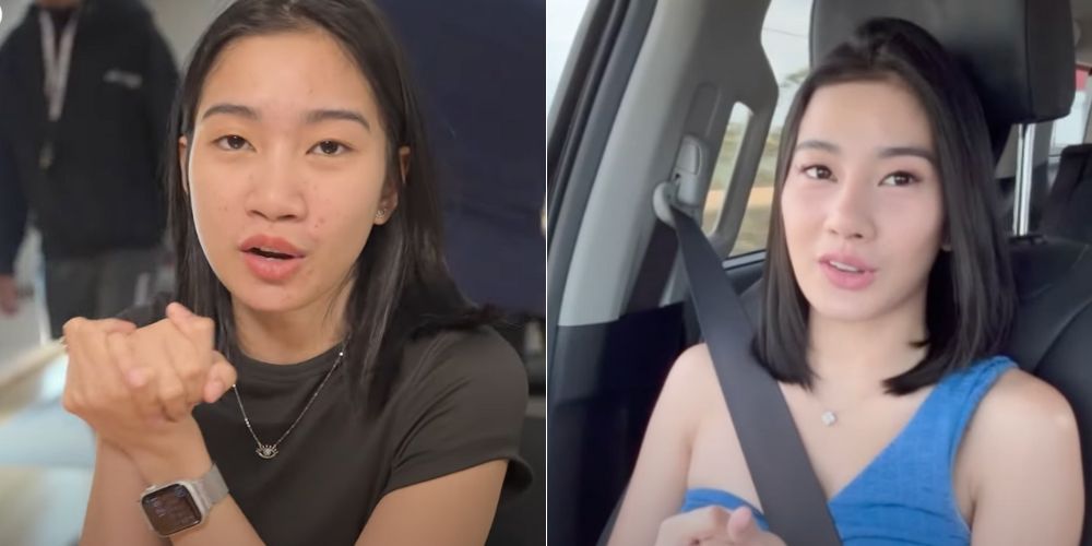 Vien Iligan reveals her new look after rhinoplasty, chin augmentation