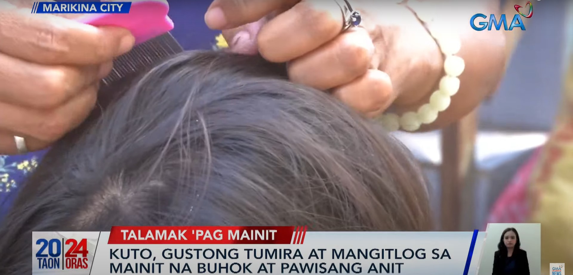 DOH warns public against lice infestation this summer