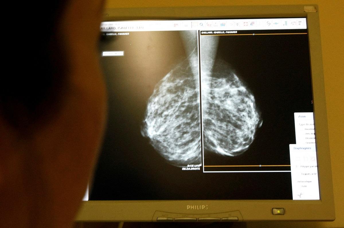 US panel recommends all women receive breast cancer screening from 40