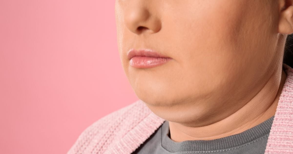 Dealing with double chin? Here are 3 ways to tone, tighten the chin and jaw area