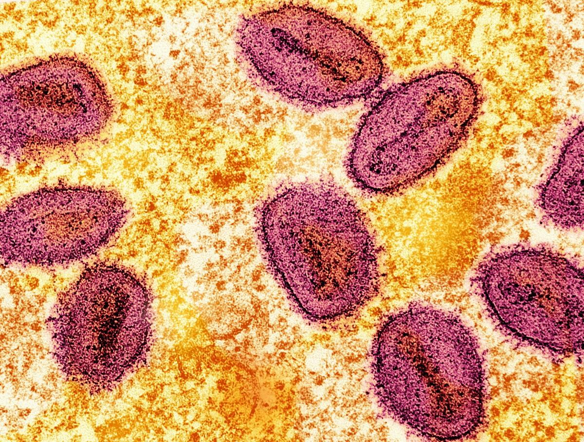 China discovers cluster of new mpox strain