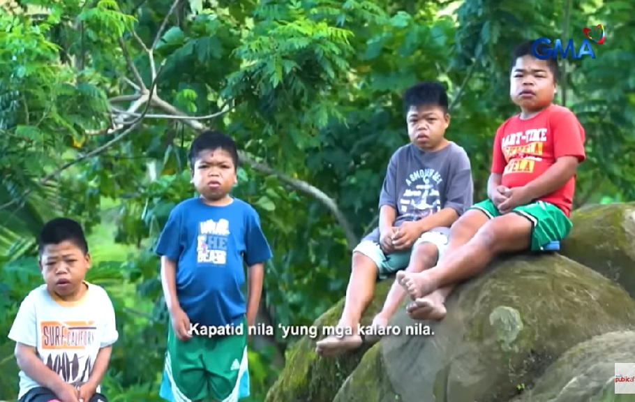 Magpipinsan na mabilis na nagmukhang matanda pero 'di lumaki, itinago ng pamilya sa bundok  thumbnail