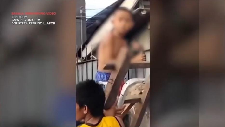 Batang lalaki sa Cebu, natusok ng bakal ang braso