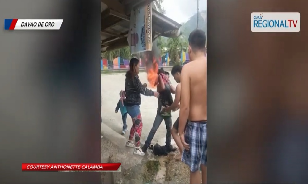 Batang babae, nalapnos sa mukha at katawan nang matumba at magliyab ang sinasakyang motorsiklo