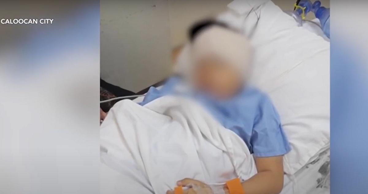 6-taong gulang na bata, kritikal matapos bugbugin umano ng nanay ng kalaro