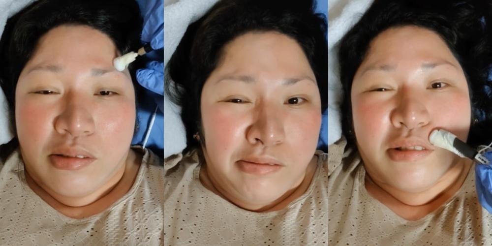 Frenchie Dy shares improvement as she undergoes therapy following Bell's palsy attack