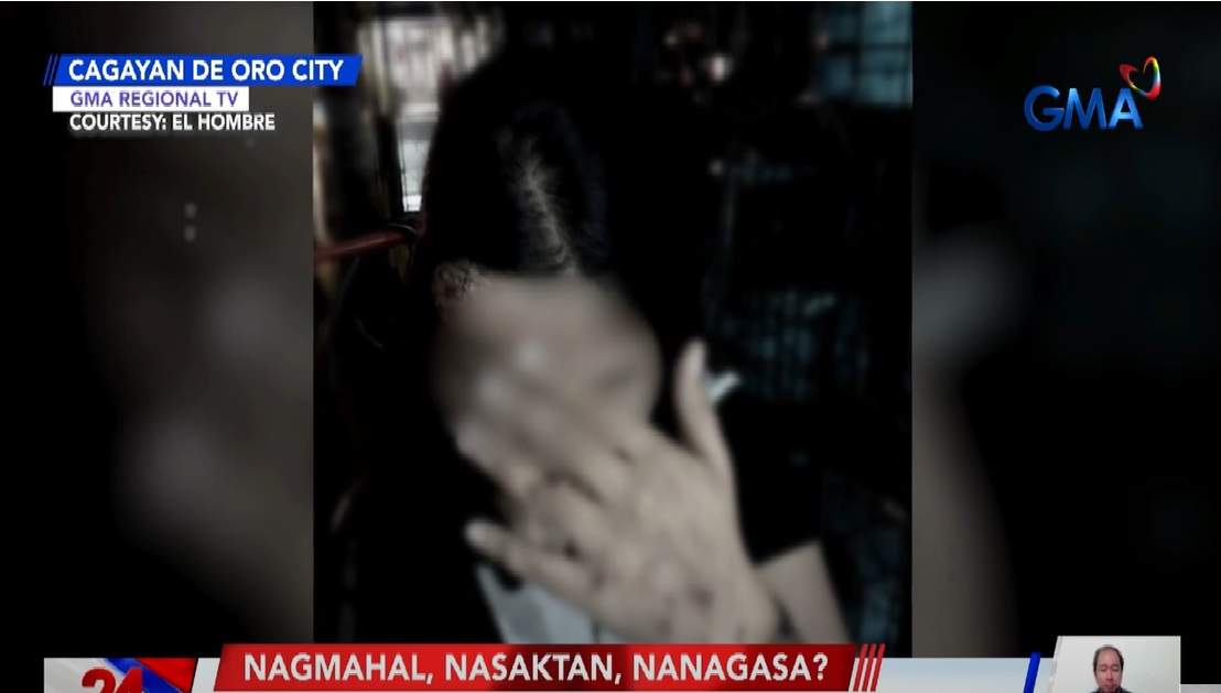 Babae, sugatan matapos umanong banggain ng kotse; suspek, dating nobyo ng biktima