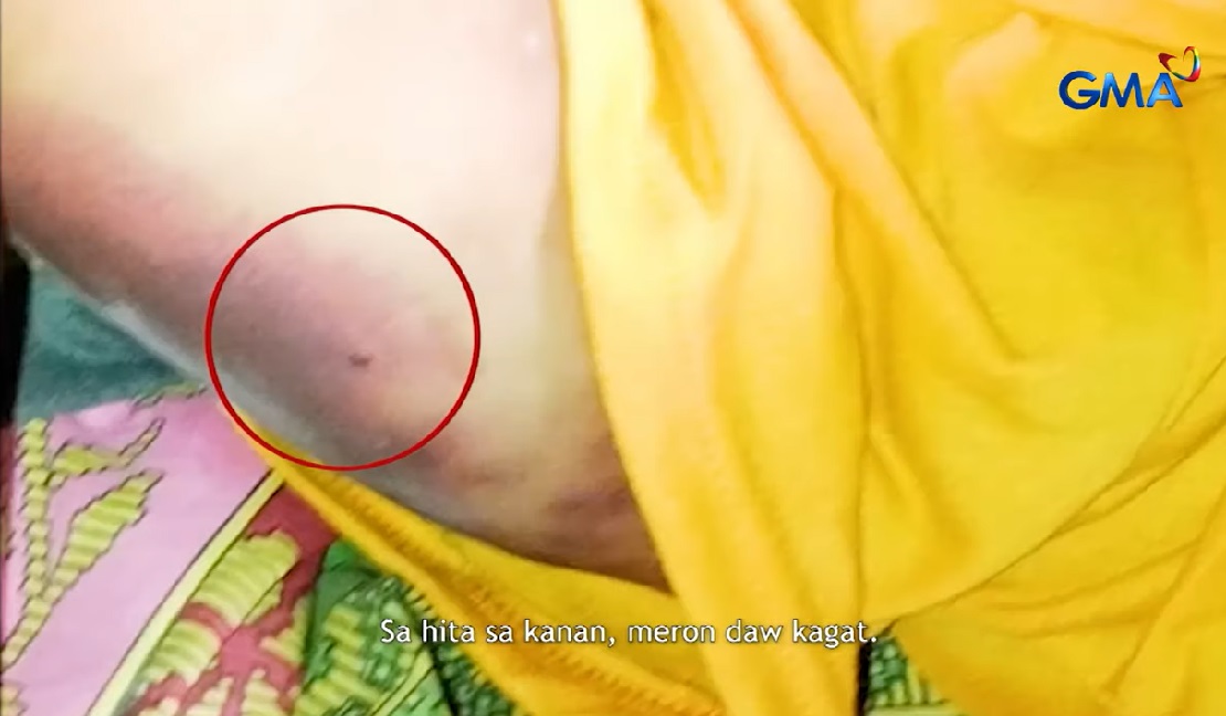 Bata sa Maguindanao del Norte, nasawi dahil sa tuklaw ng ahas o dahil sa kagat umano ng aswang? thumbnail