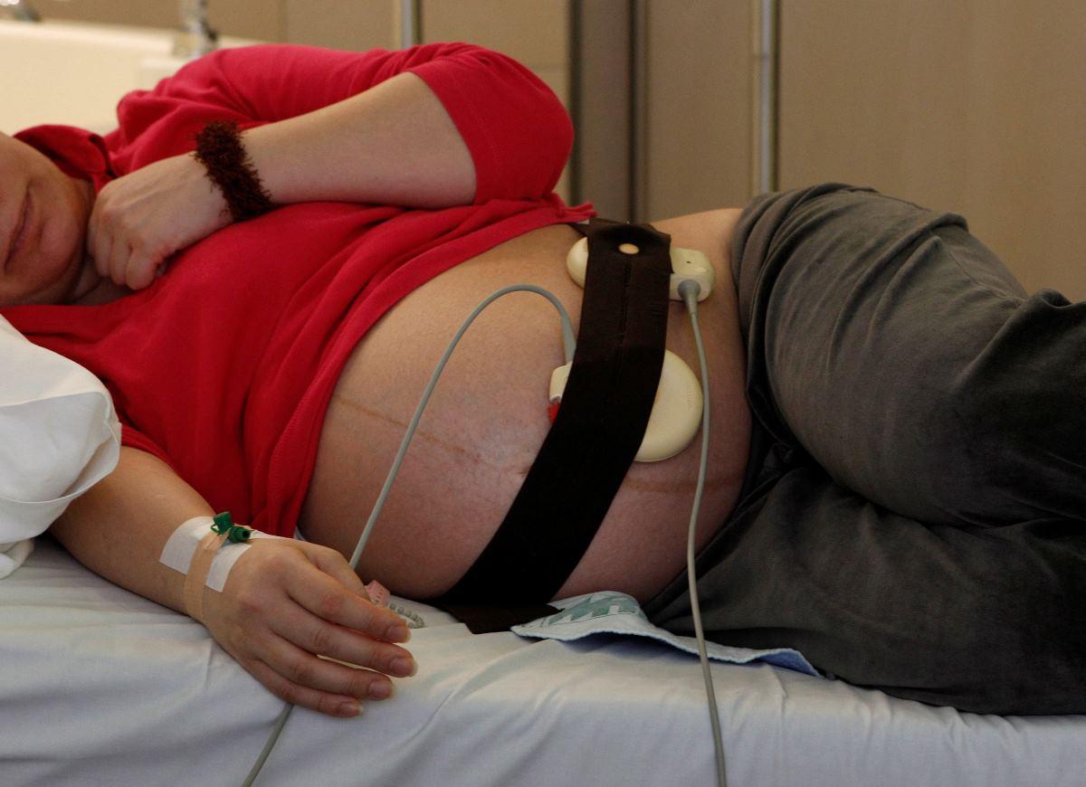 pregnant woman is monitored with a cardiotocograph