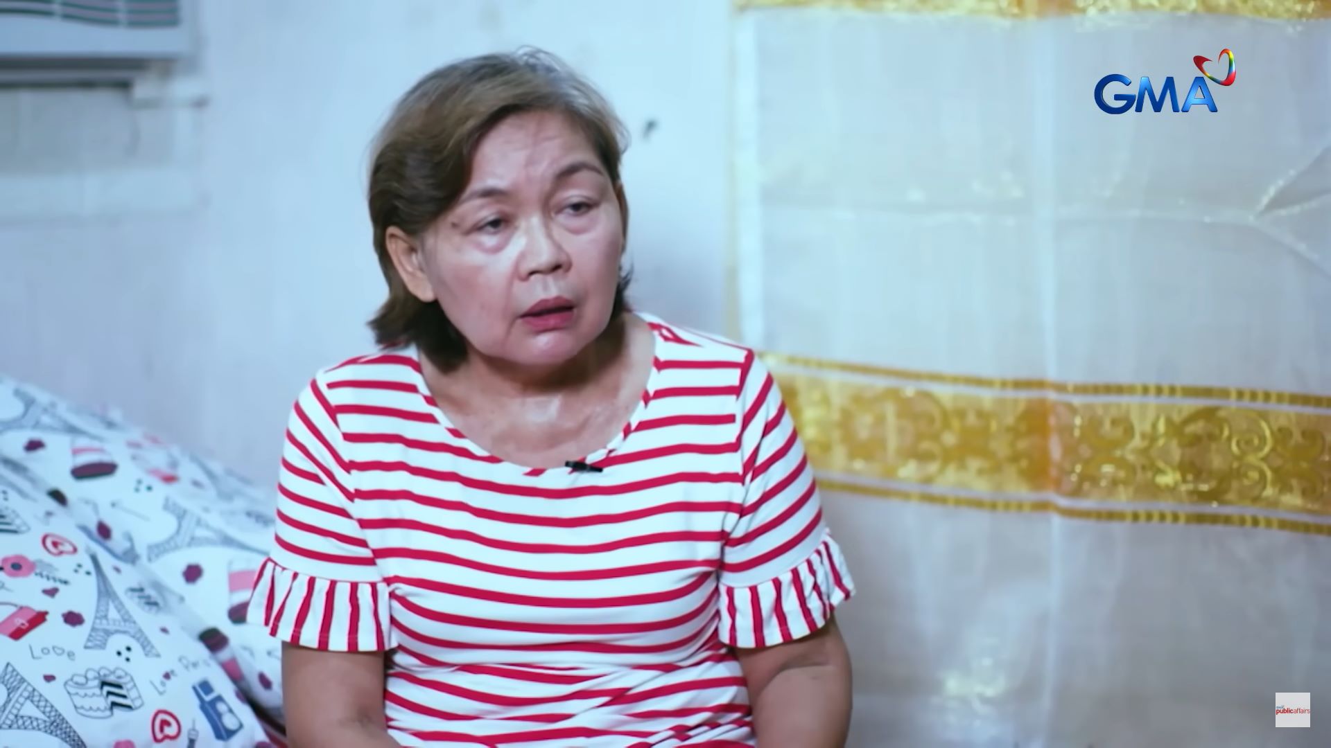 Lola, pinutulan ng binti matapos masugatan ng palikpik ng tilapia