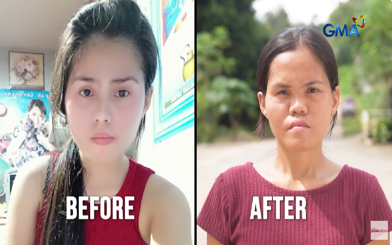 Babae, nilait dahil sa kaniyang throwback photos na malayo sa hitsura niya ngayon thumbnail