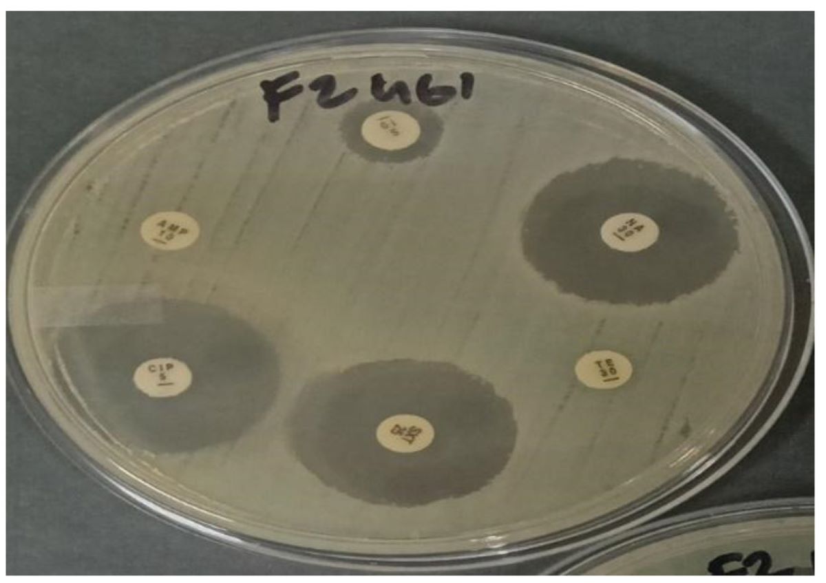 UP researchers use AI models to predict antimicrobial resistance