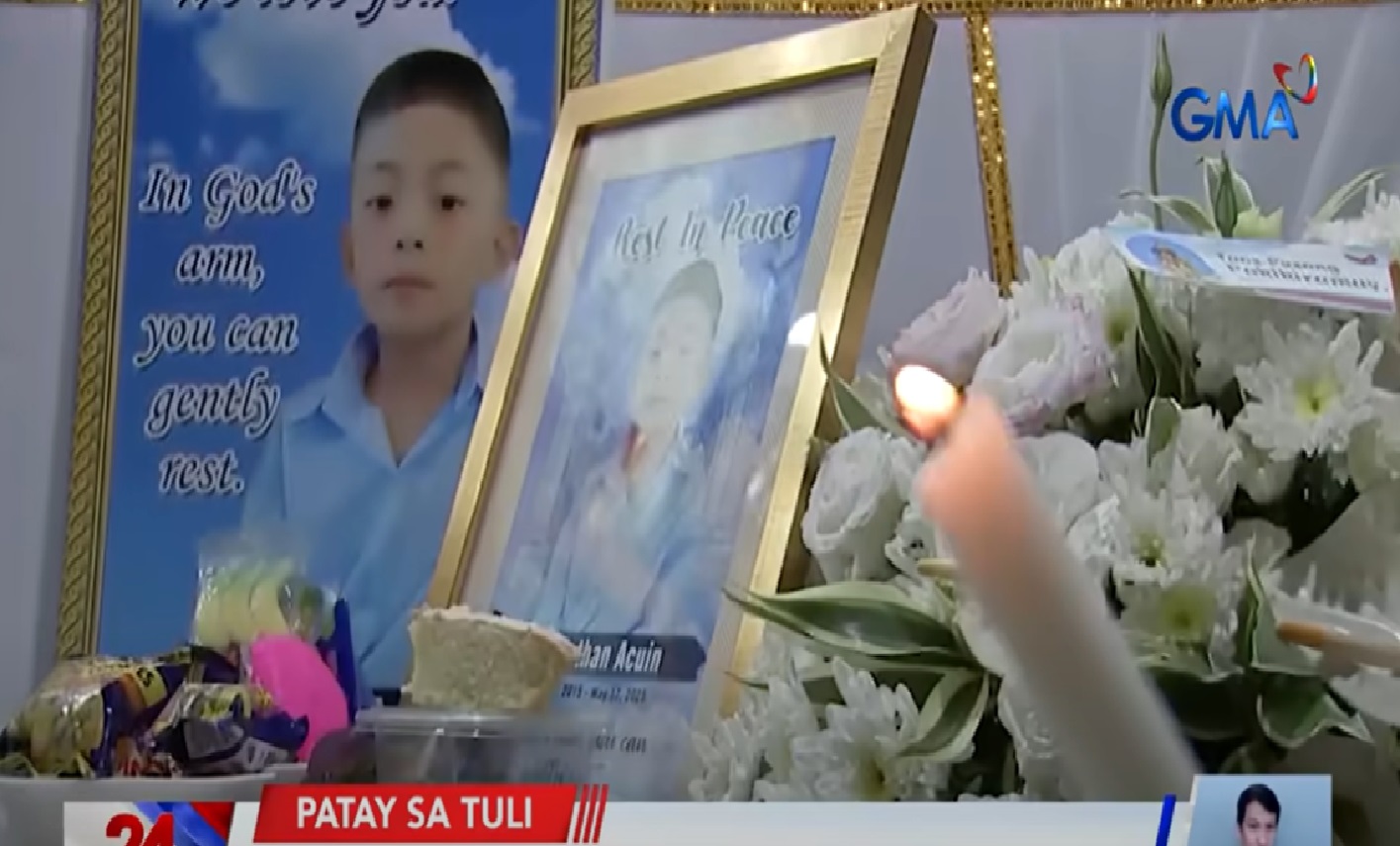 Batang namatay matapos matuli, nagkaroon ng pagdurugo sa utak, ayon sa pulisya