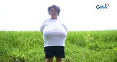 Babae sa South Cotabato, ano nga ba ang sanhi ng paglaki ng dibdib? thumbnail